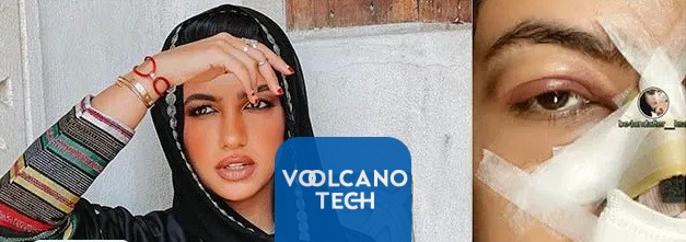 تغيرات شكل نجلاء