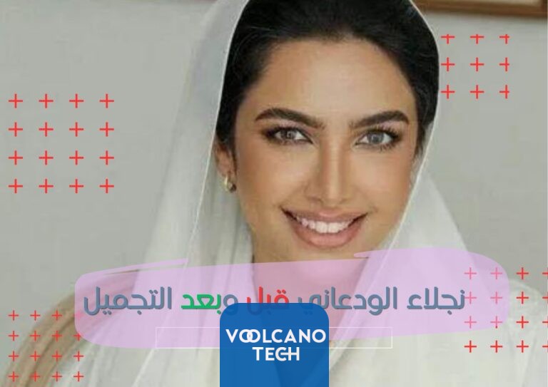 نجلاء الودعاني قبل وبعد التجميل