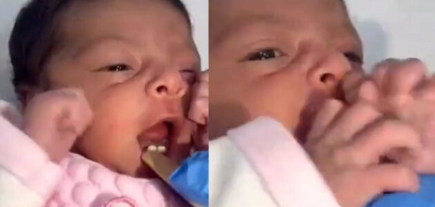 شاهد حالة نادرة لولادة طفلة بأسنان أمامية تثير استغراب رواد مواقع التواصل