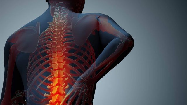 علاج الاحتكاك في فقرات الظهر بالأعشاب المجربة والطب البديل