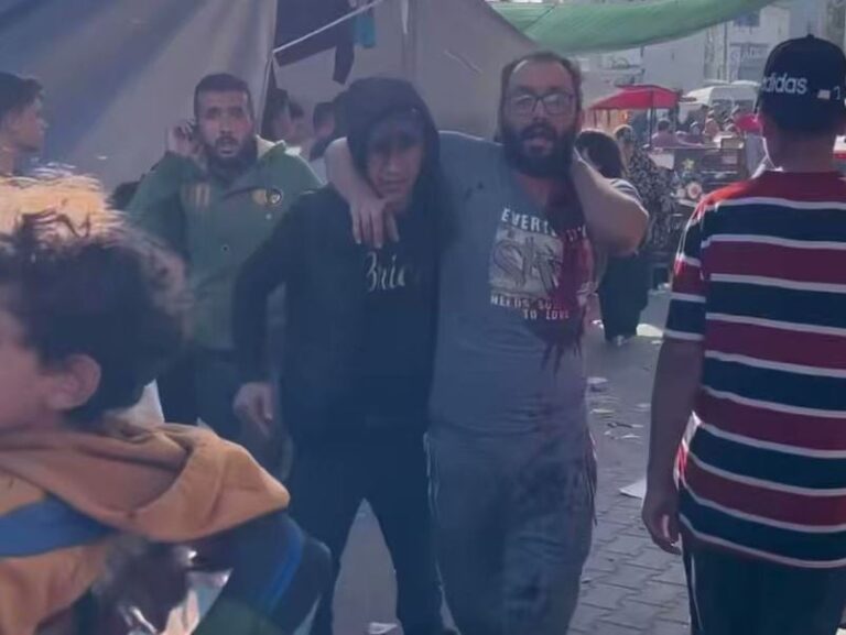 فيديو.. مستشفى الشفاء بغزة يتعرض لقصف إسرائيلي ويحاصرها الدبابات