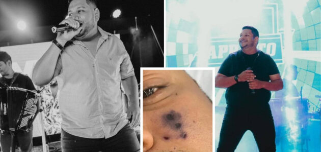 لدغة عنكبوت مميتة تنهي حياة مطرب برازيلي