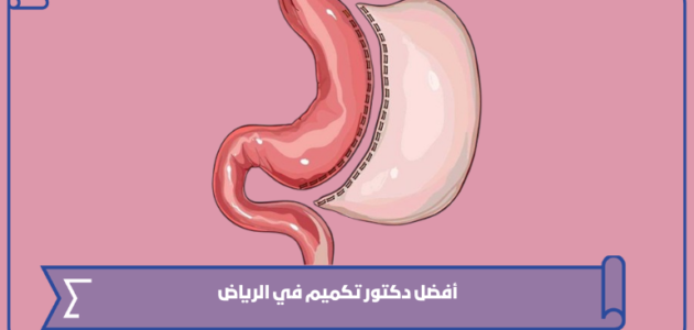 أفضل دكتور تكميم في الرياض 2024