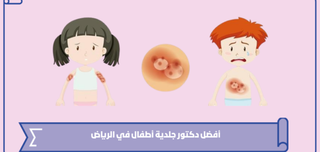 أفضل دكتور جلدية أطفال في الرياض 2024