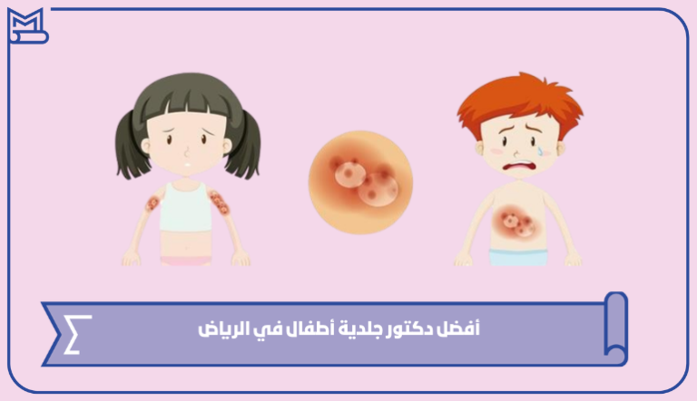 أفضل دكتور جلدية أطفال في الرياض 2024 – صقور الخليج