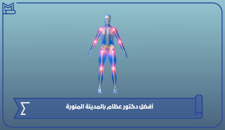 أفضل دكتور عظام بالمدينة المنورة 1445 – صقور الخليج