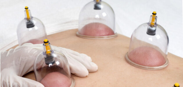 دليلك الشامل لأماكن وضع كاسات الهواء للحمل وفوائدها ومخاطرها