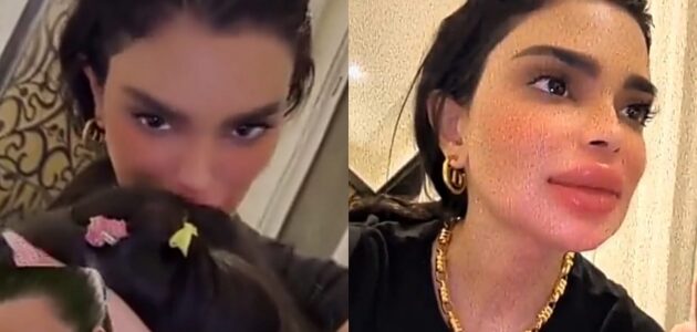 شاهد ردة فعل ابنة أودي الزبن بعد تغير ملامح والدتها بسبب عمليات التجميل