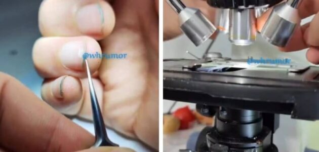 شاهد ماذا رأى باحث فحص الأظافر بالمجهر