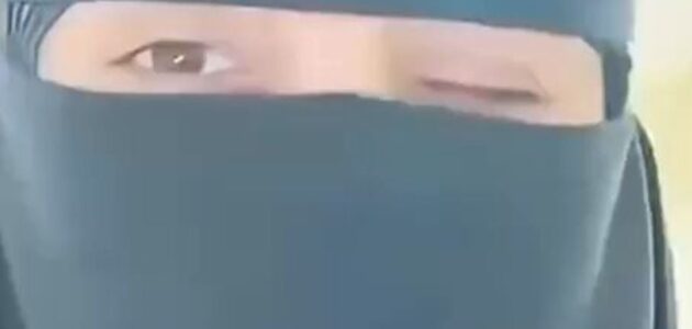 فيديو.. فتاة تكشف عن فقدان إحدى عينيها بسبب استخدام عدسات لاصقة للزينة وتُحذر