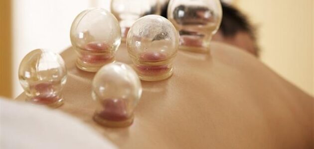 استشاري أمراض المناعة والعدوى يفجر مفاجأة بشأن الحجامة