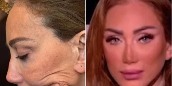 جراح تجميل شهير يرد على اتهامات تشويه وجه الإعلامية ريهام سعيد