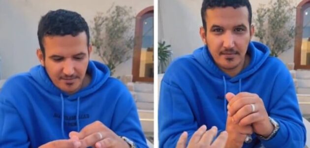 شاهد شاب سعودي يفشل في خلع خاتم الزواج من يده منذ 3 سنوات لسبب غريب