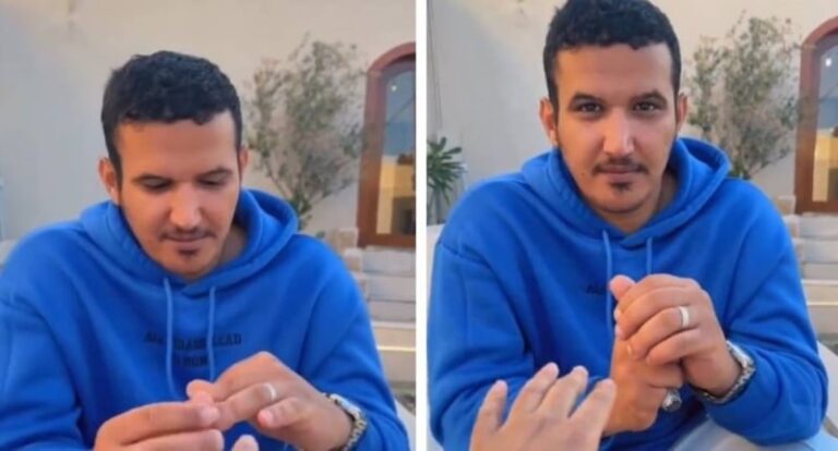 شاهد شاب سعودي يفشل في خلع خاتم الزواج من يده منذ 3 سنوات لسبب غريب