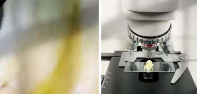 شاهد ماذا وجد مختص عندما فحص قطعة من الإندومي تحت المجهر