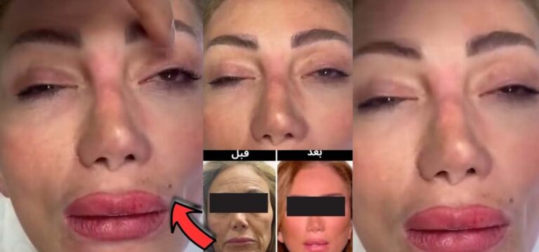 شاهد نادر صعب ينشر فيديو صادم لـ ريهام سعيد وهي تحت التخدير أثناء قيامه بعملية التجميل لها