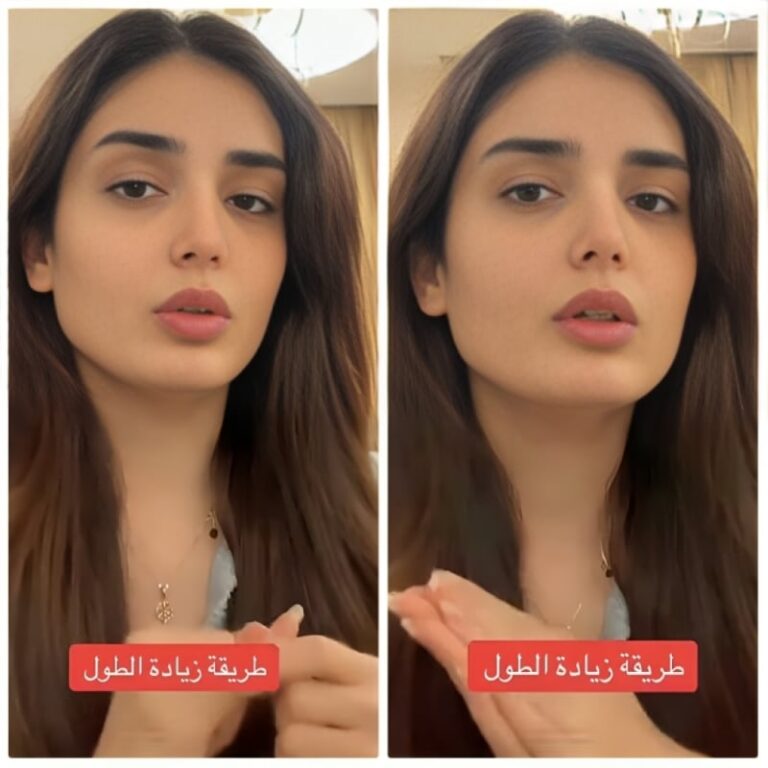 فتاة تكشف عن تجربتها في زيادة طولها 170 سم