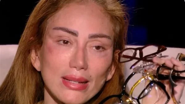 بعد اتهام ريهام سعيد لطبيب تجميل بهتك عرضها وإحداث عاهة مستديمة.. أول قرار من النيابة المصرية
