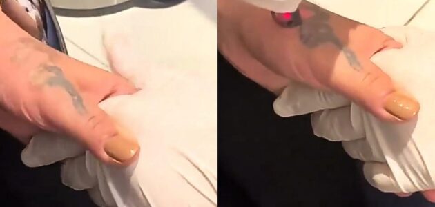 شاهد ردة فعل فتاة لحظة إزالتها للوشم