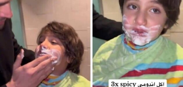 شاهد ماذا حدث لطفل بعد تناوله وجبة إندومي حارة
