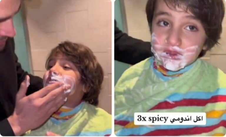 شاهد ماذا حدث لطفل بعد تناوله وجبة إندومي حارة