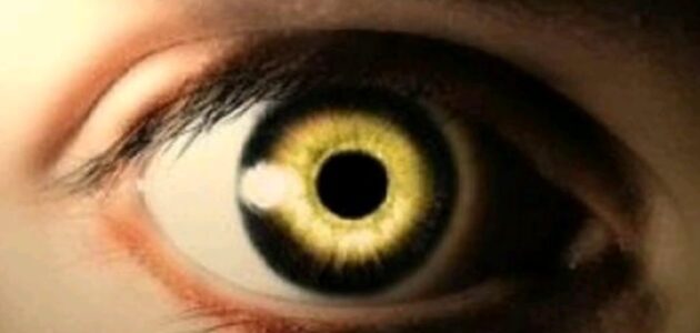 علامات العين القوية – موسوعة